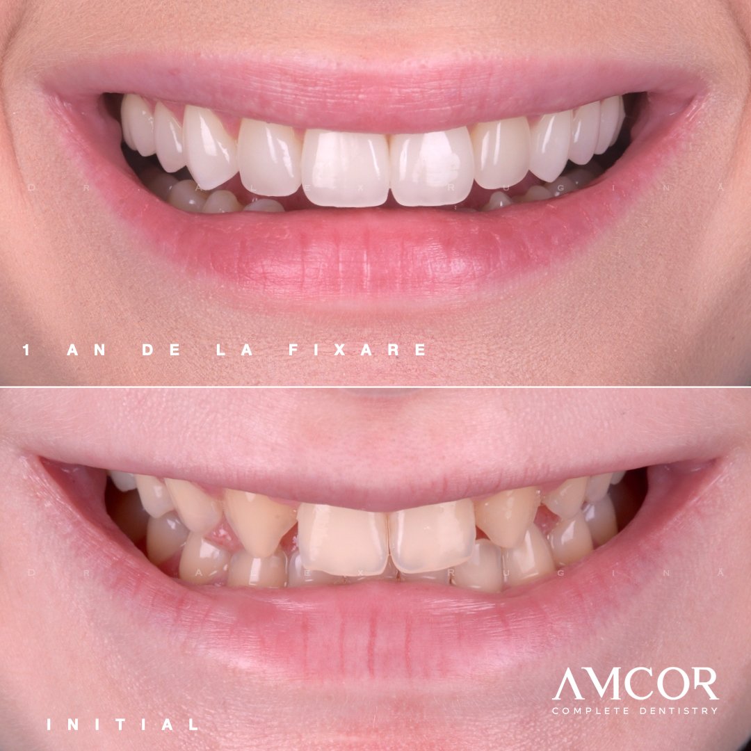 Estetică dentară — clinica AMCOR