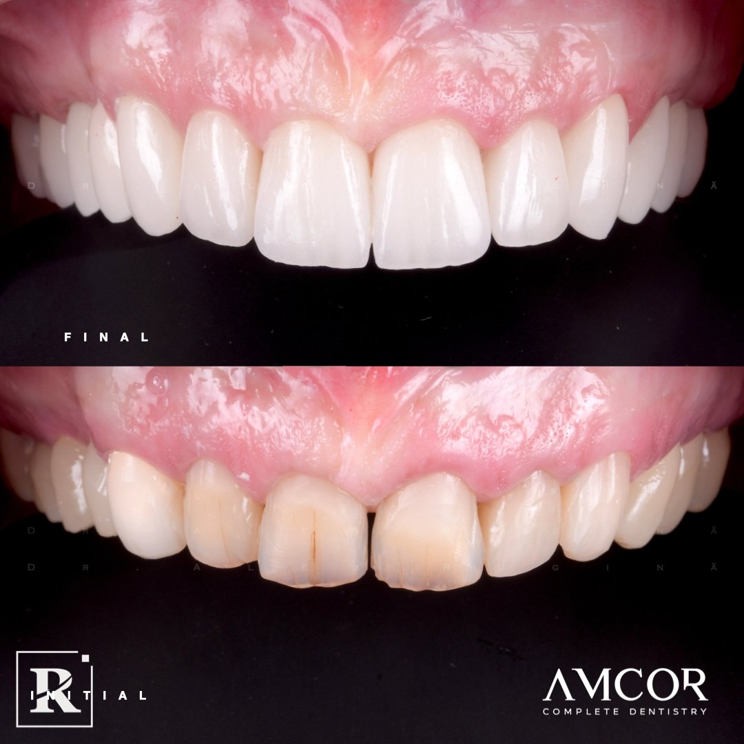 Reabilitare orală — clinica AMCOR
