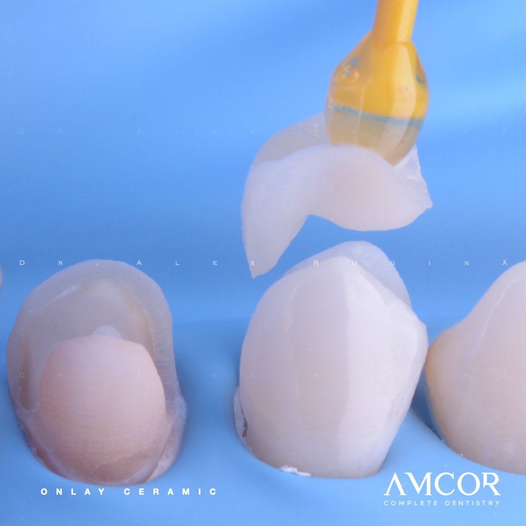 Stomatologie restaurativă — clinica AMCOR